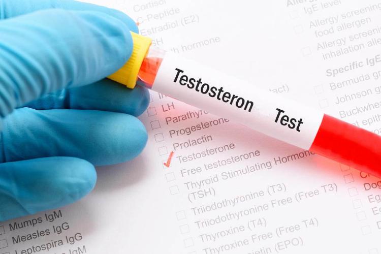 Hladinu testosteronu vám změří lékař z odběru krve.