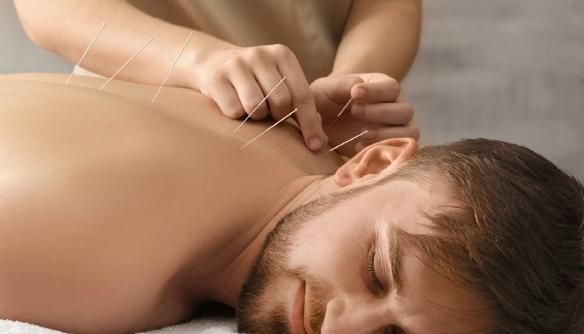 4 dolog, amire jó lehet az akupunktúra | Well&fit Akupunktúrás pontok az erekcióhoz